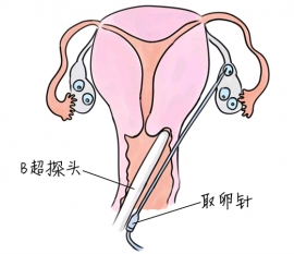幼儿学画画，重庆捐卵宝宝学画画，学画画的好处，如何学画画
