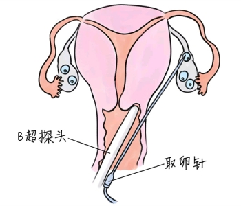 幼儿学画画，重庆捐卵宝宝学画画，学画画的好处，如何学画画